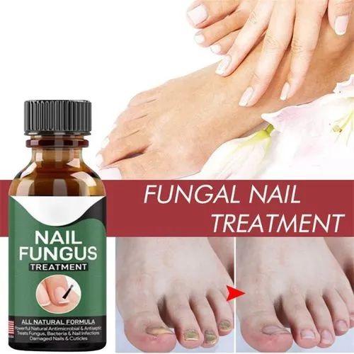 Nail Fungus Treatment Serum 10ml