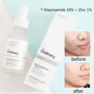 Special offer Niacinamide 10% + Zinc 1% Serum Oil Balance Whitening Moisturizer Original Essence Hydrating Skin Care 30mL