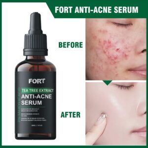 FORT Salicylic Acid Face Serum – Acne & Dark Spot Removal